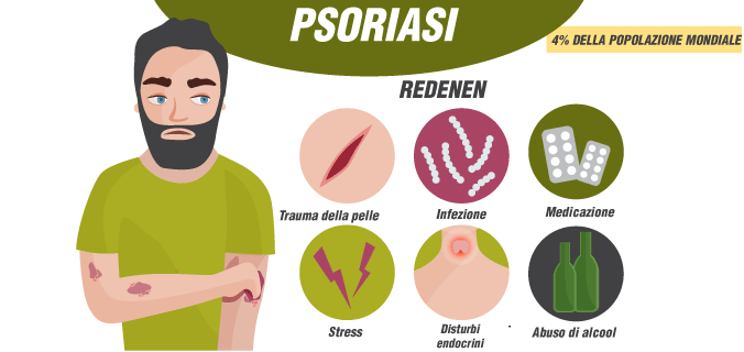  Principali cause della psoriasi